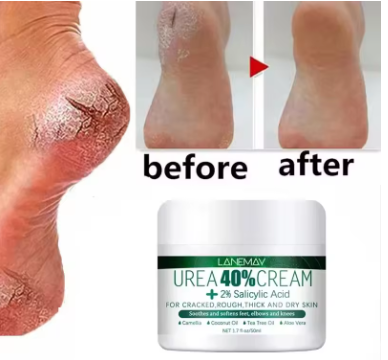 erbal Anti-Crack Foot Cream – Heels Repair & Skin Softening