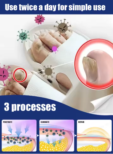 7-Day Nail Repair Treatment – Manicure for Damaged Nails